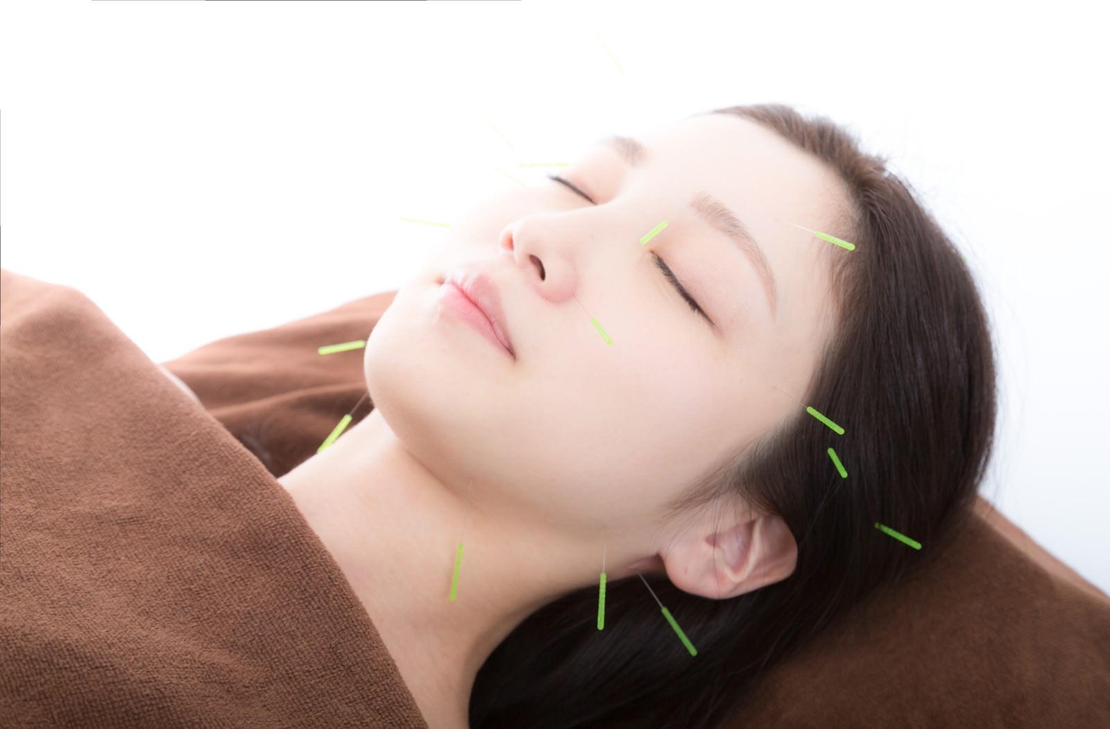 Beauty-acupuncture
