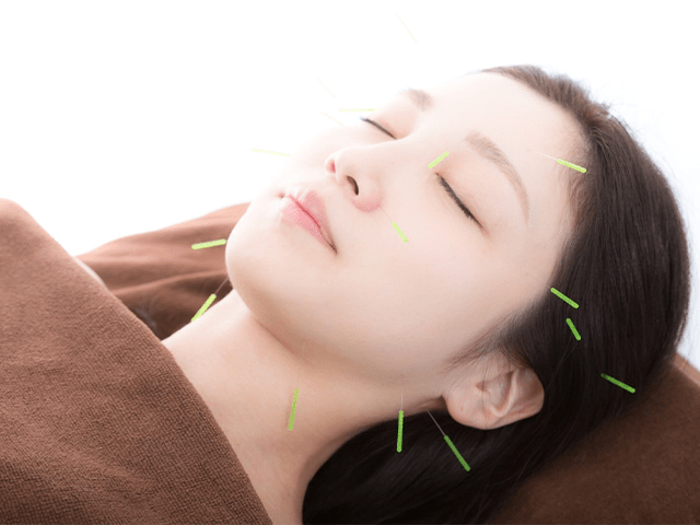 Acupuncture